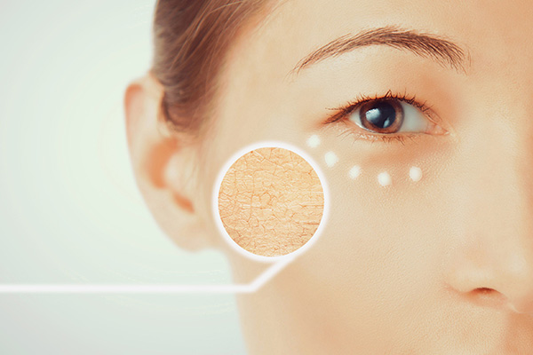 9 Tips To Combat Dry Skin & Dehydrated Skin