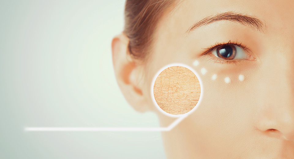 9 Tips To Combat Dry Skin & Dehydrated Skin - Image