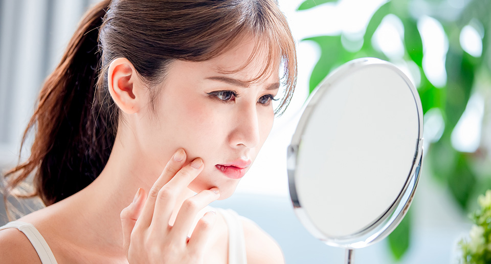 Bye, Breakouts: 6 Best Skincare Ingredients for Acne-Prone Skin - Image 1